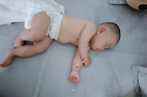 巴音郭楞蒙古宝宝脸上有白色斑块